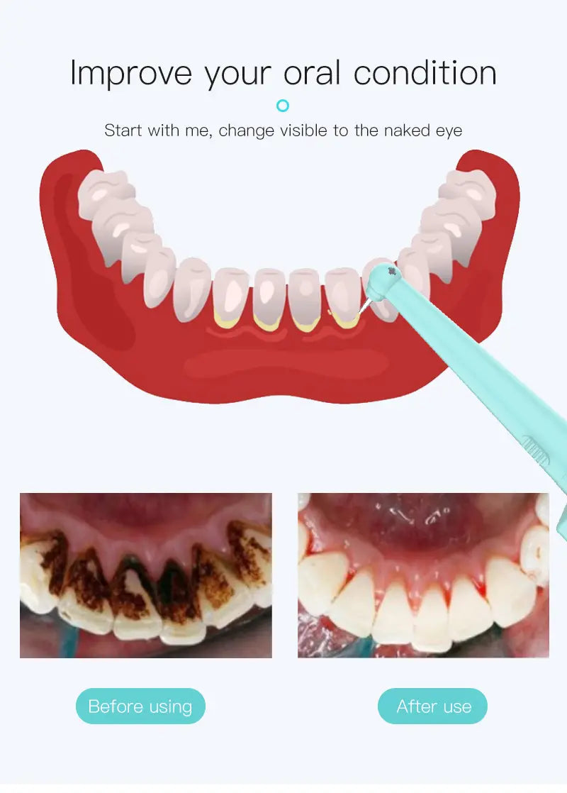 LED Smart Tooth Cleaner with Dual Heads & Multi-Modes Aurexia off